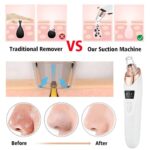 Multifunctional Electric Blackhead Remover - Image 5